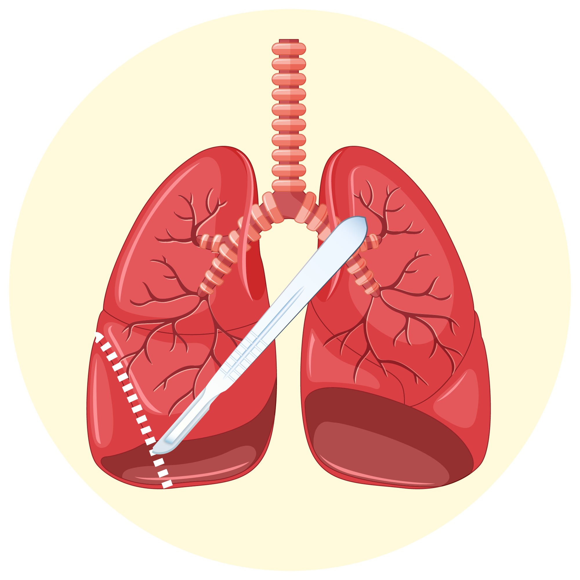 cirugia-cancer-mama-xalapa-veracruz