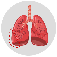icono-mastectomia-xalapa