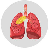 icono-mastectomia-xalapa